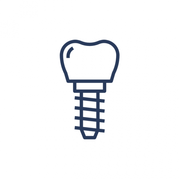 Implantul Dentar